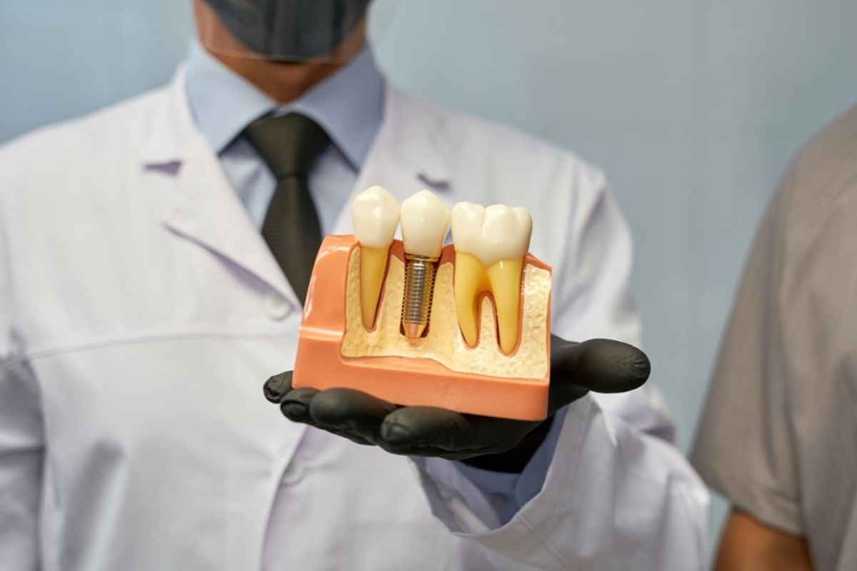 Why Dental Implants Are A Permanent Solution For Missing Teeth