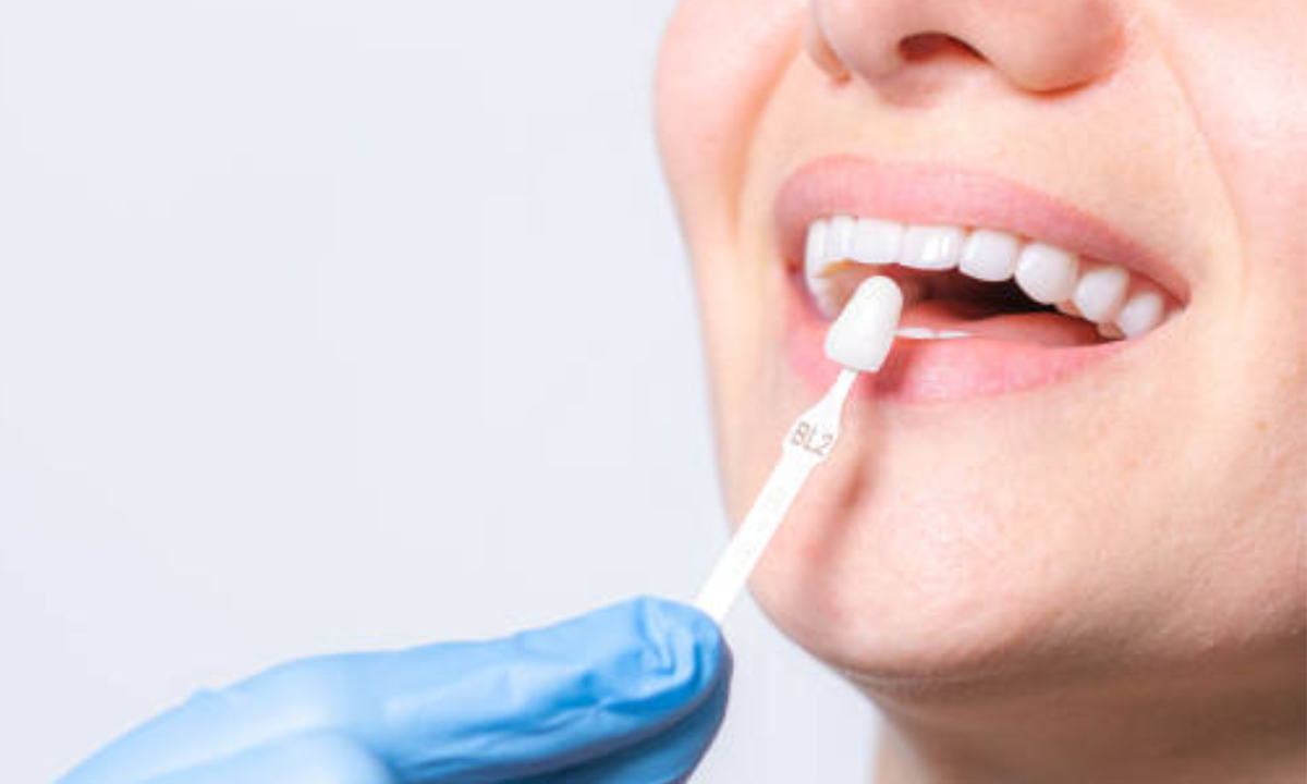 5 Cosmetic Treatments General Dentists Use To Enhance Everyday Smiles